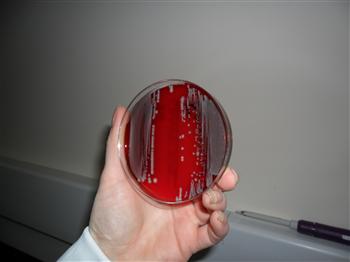 4 antibacterials bacteriology