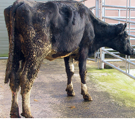 Chronic infestation of liver fluke