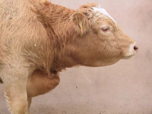 Extensive fluid accumulation