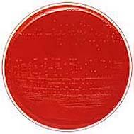 Bactoscan problems and solutions