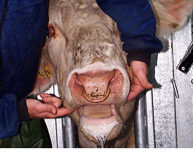 Profuse salivation in an early case of wooden tongue