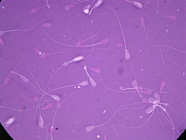 14 normal spern cells
